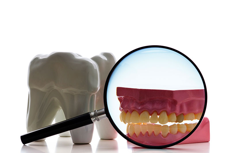 Root Canal in San Luis Obispo